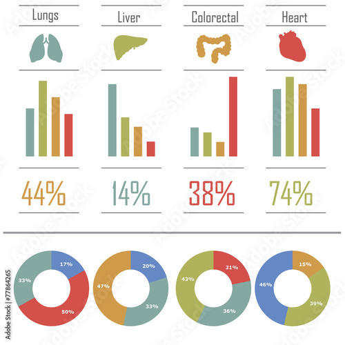 infografics
