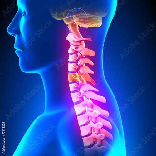 C5 Disc - Cervical Spine photo