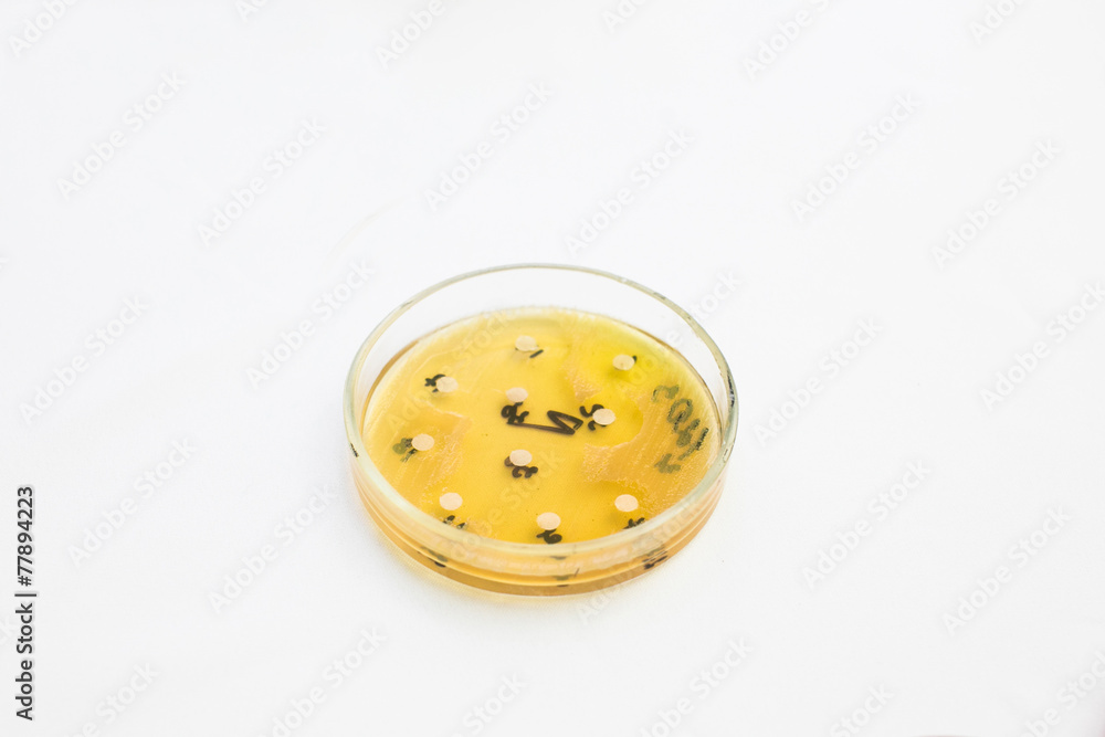 Fototapeta premium Petri dish with growing bacteria