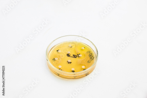 Petri dish with growing bacteria