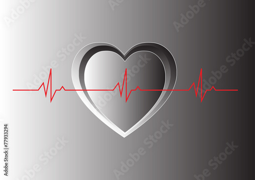 Echocardiogram show  normal sinus rhythm, Heart beat, EKG lead 2 