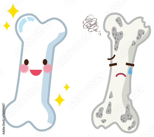 Foto 健康な骨と弱い骨