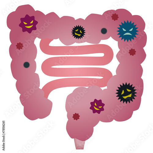 病気の大腸　人体　内臓 photo
