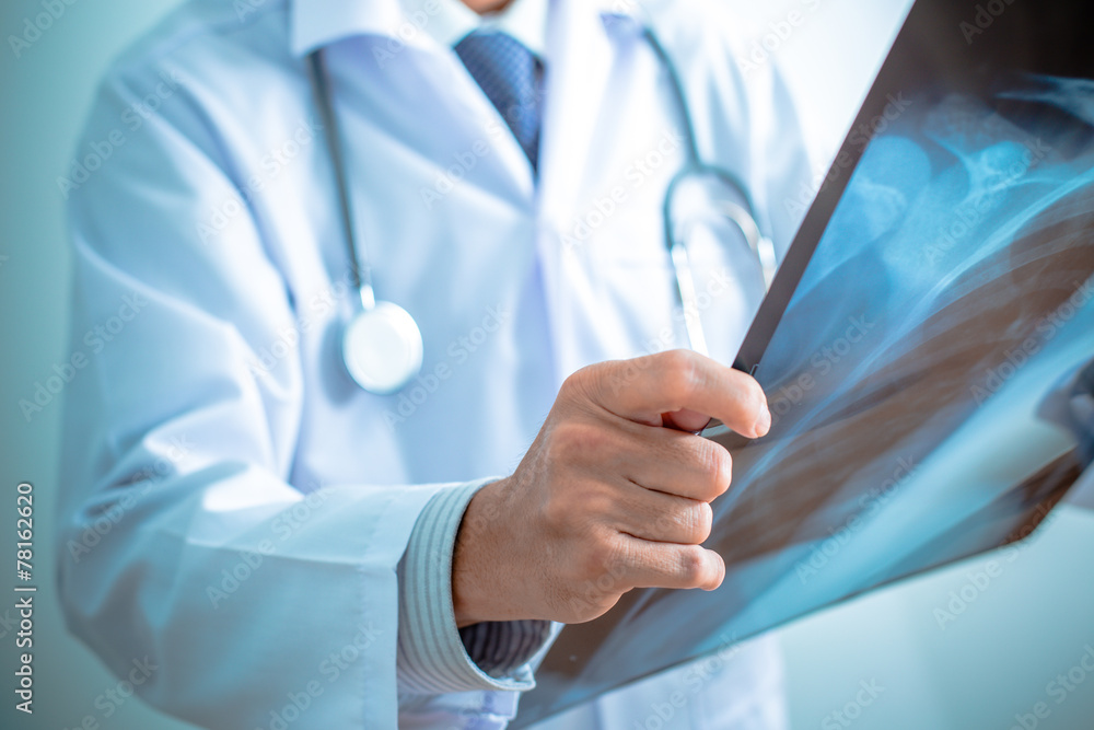 close up of male doctor holding x-ray or roentgen image close up of male doctor holding x-ray or roentgen image
