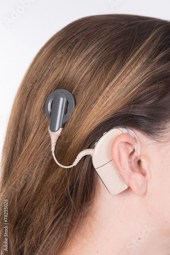 Young woman with cochlear implant