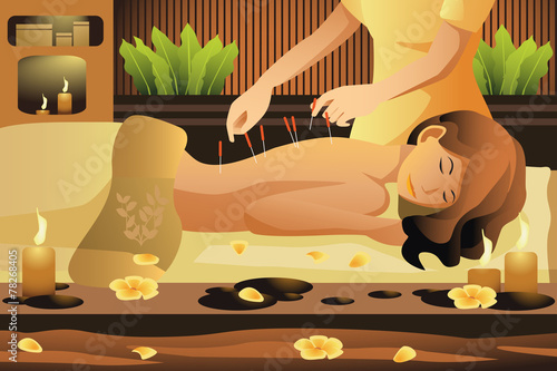 Acupuncture therapy