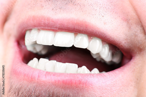 Smiling man after visit dentist om blurred background, macro