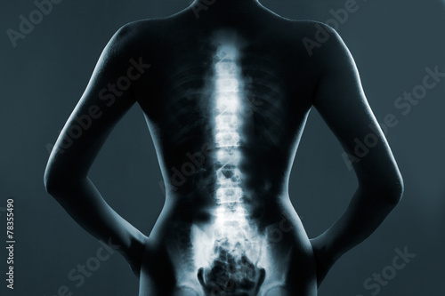 Human backbone in x-ray