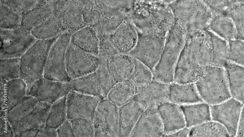 Movement and division of  colorectal cancer cells in culture