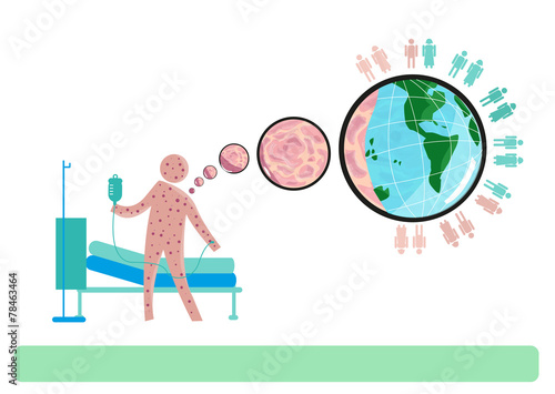 Disease Outbreak from One Person  to others worldwide.