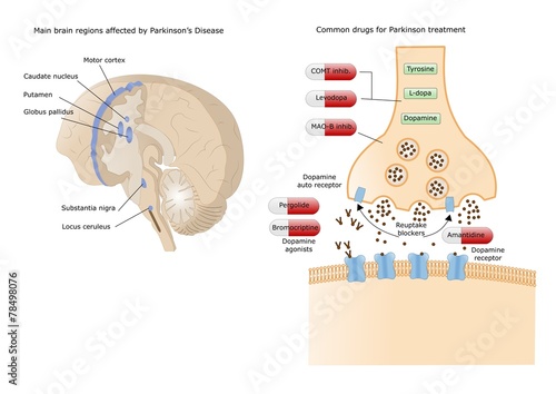 morbo di Parkinson, neurodegenerazione, farmaci