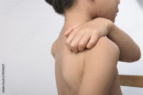 Urticaria in kid treat by wax