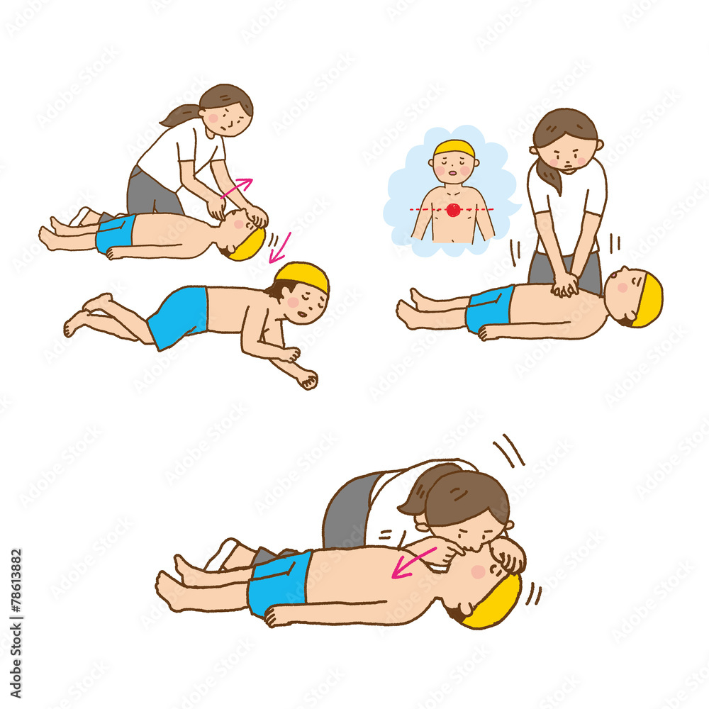 女性こども人工呼吸イラストstock Vector Adobe Stock
