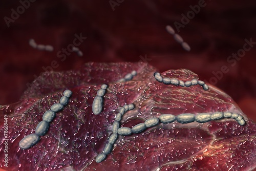 Canvastavla Streptokokken