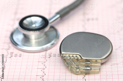Electrocardiograph with stethoscope and pacemaker photo