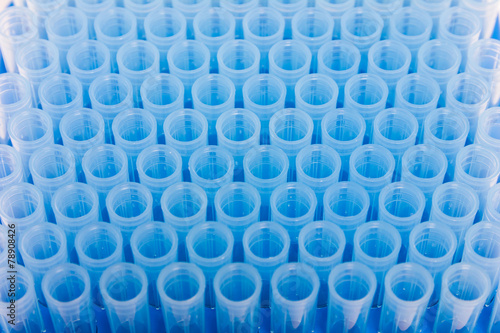 laboratory blue tips 1 ml