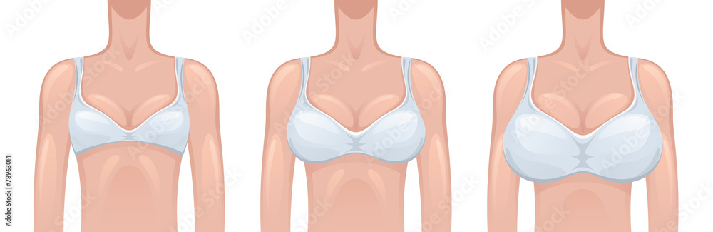 Vetor do Stock: breast size and type vector