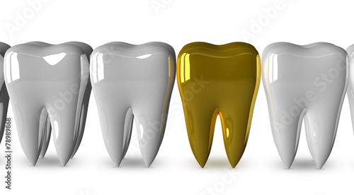 Golden tooth and white ones photo