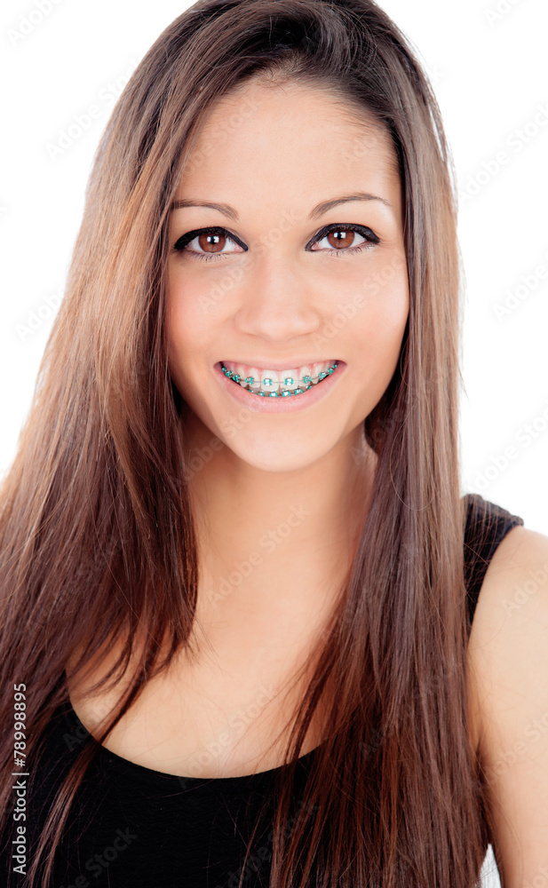 Attractive smiling girl with brackets Attractive smiling girl with brackets