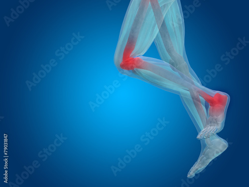 Conceptual human body anatomy pain on blue