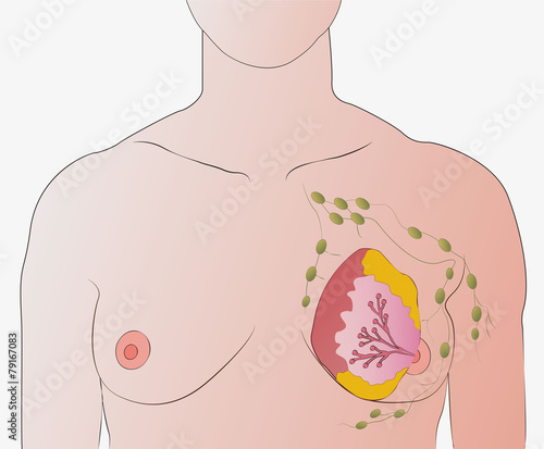 breasts and lymph nodes