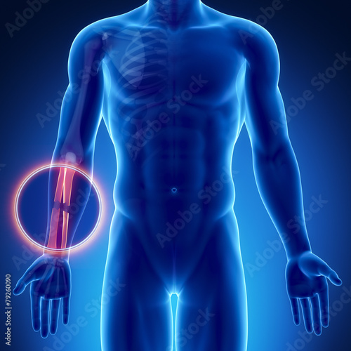 Vászonkép Male bone anatomy radius ulna broken