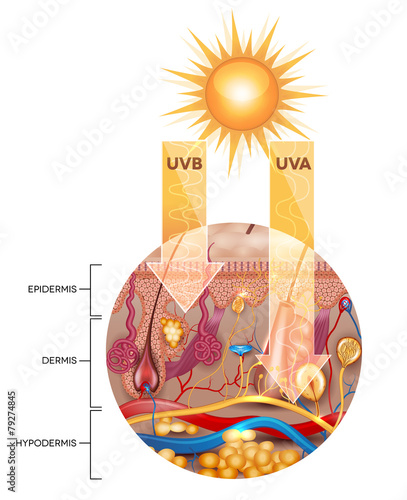 Unprotected skin without sunscreen lotion, UVB and UVA penetrate