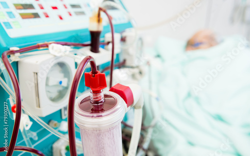 Haemodyalisis machine