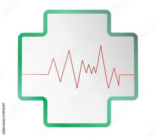 cardiac rhythm