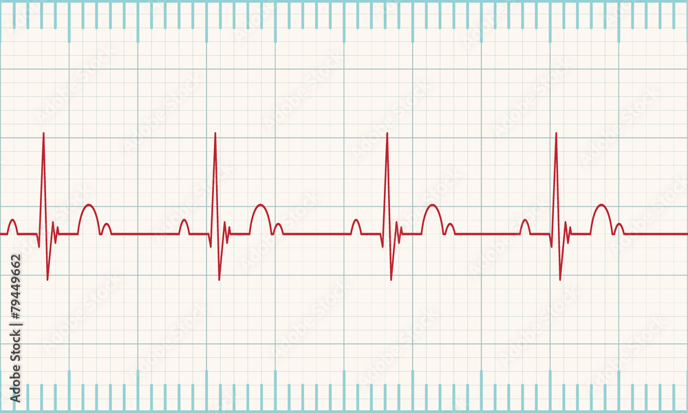 Heartbeat rate Heartbeat rate