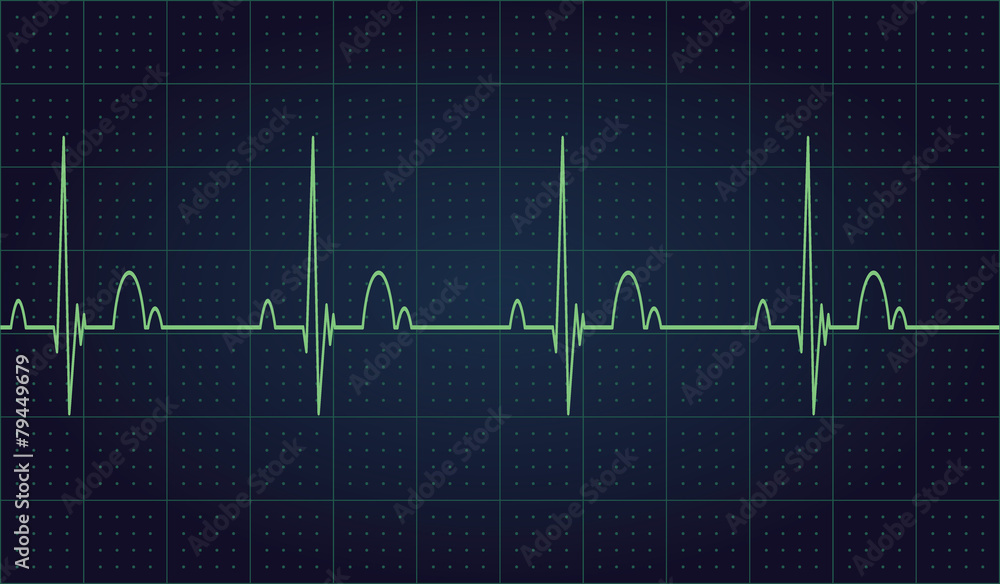 Heartbeat rate