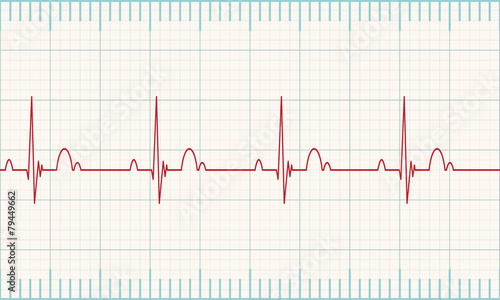 Heartbeat rate