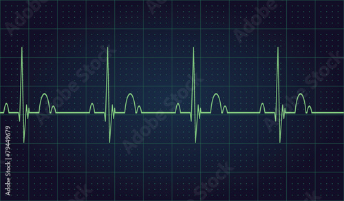 Heartbeat rate