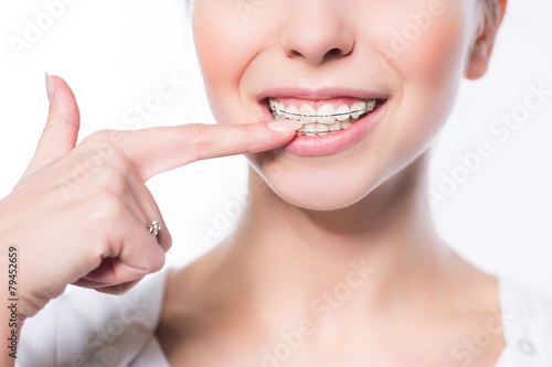 Woman with teeth braces