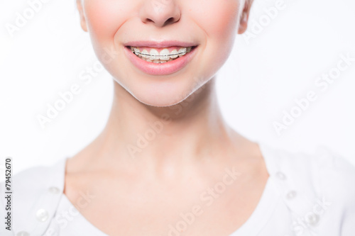 Woman with teeth braces