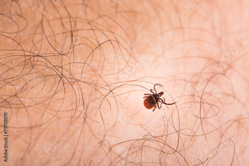 Fotografia Tick - parasitic arachnid blood-sucking carrier