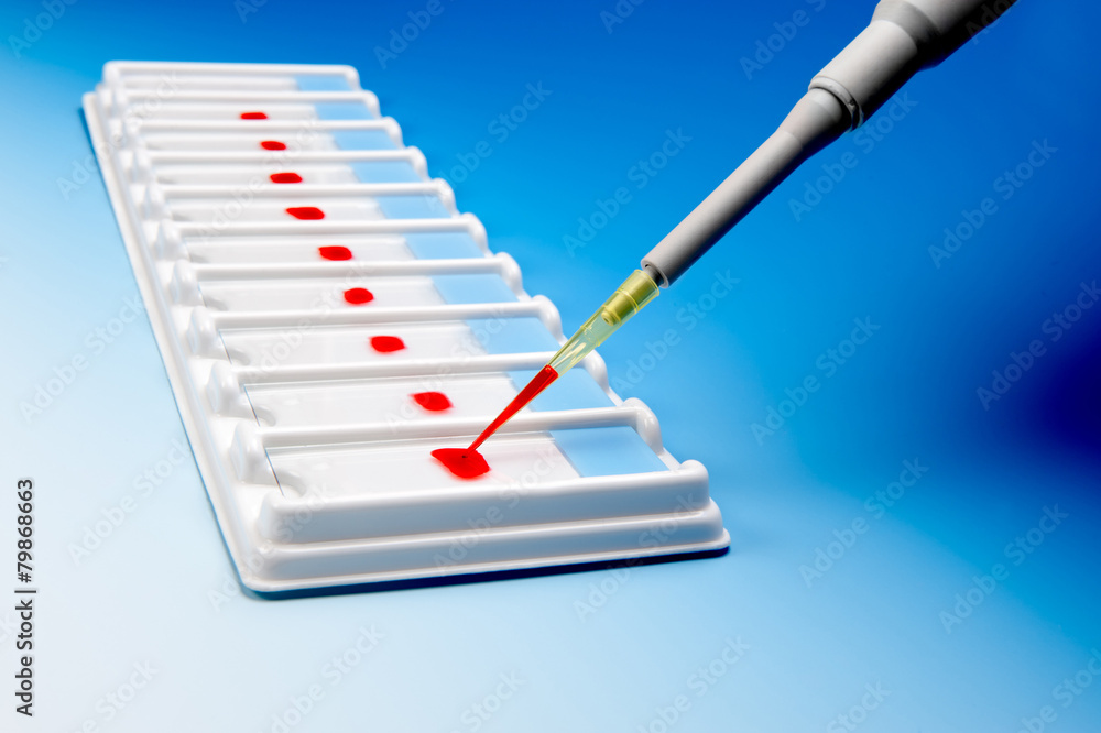 Blood microscopic samples Blood microscopic samples