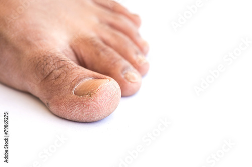 Close up dirty foot on white background