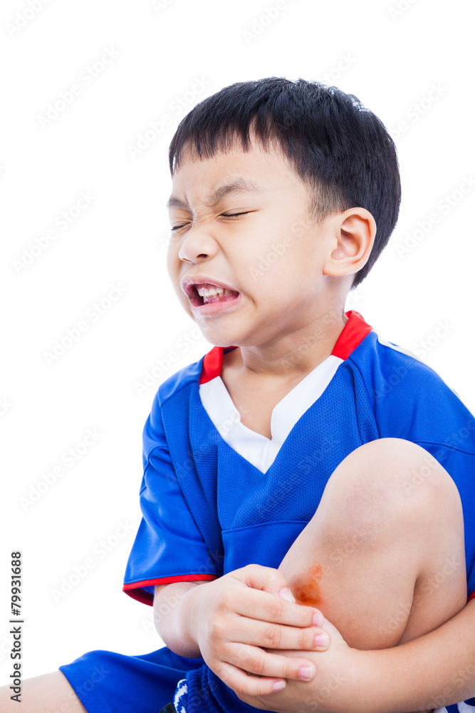 Child shin with a bruise and painful Child shin with a bruise and painful