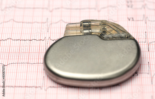 Foto Pacemaker on electrocardiograph