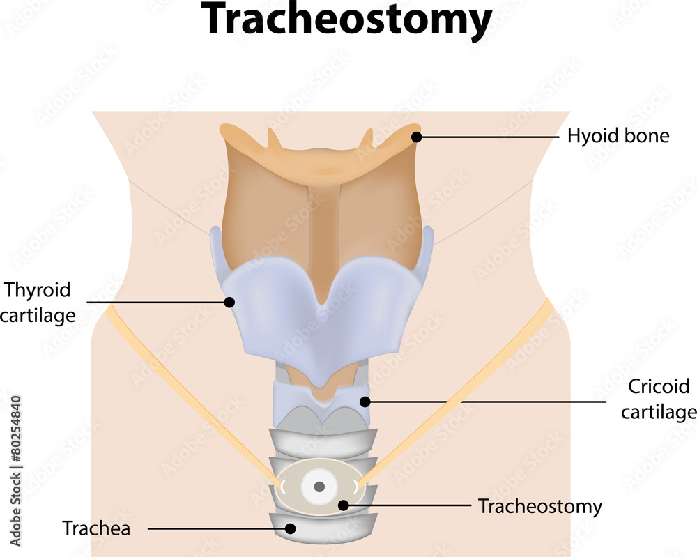 tracheal cartilage diagram