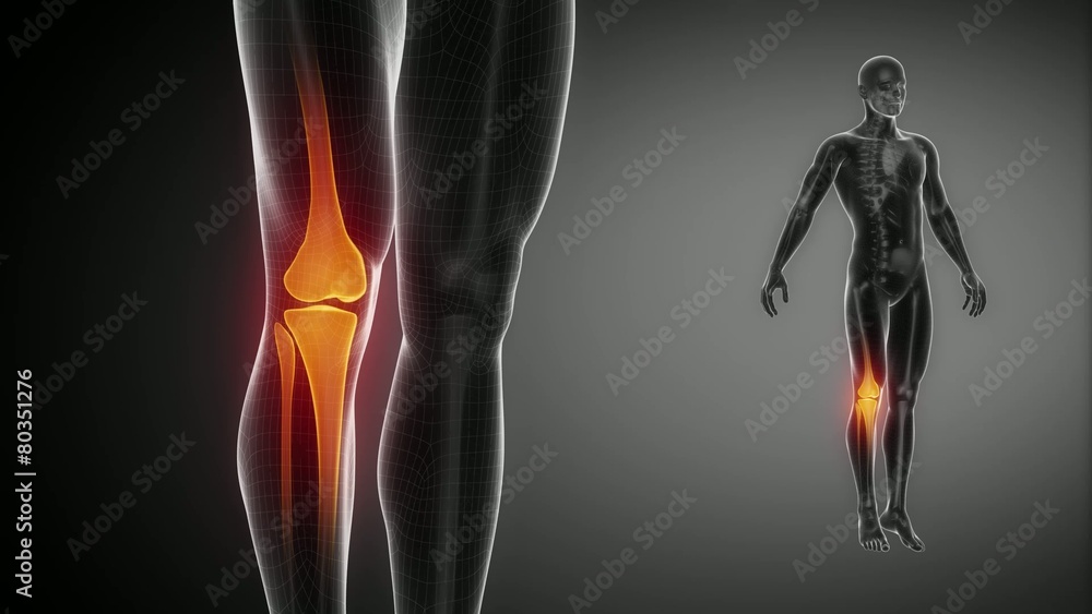 KNEE bone skeleton x-ray scan in black KNEE bone skeleton x-ray scan in black
