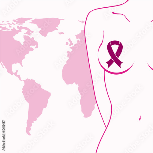 breast cancer