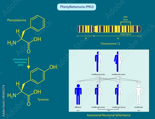 Phenylketonuria