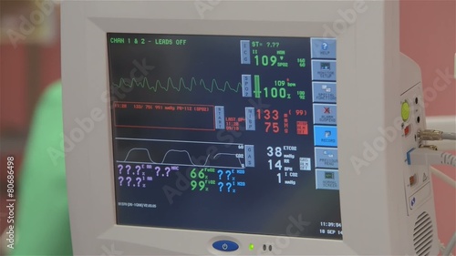 ECG monitor in the operational photo