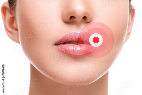 Female lips affected by herpes virus #80814458