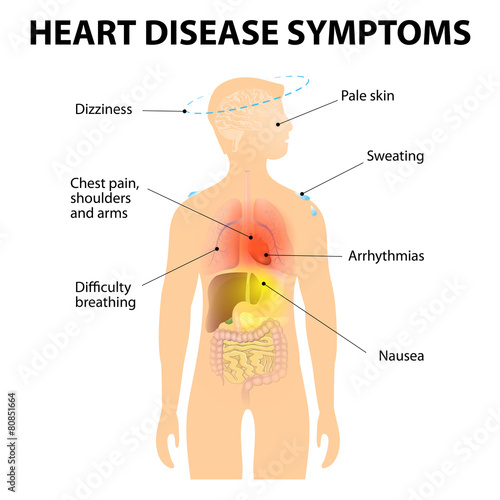 Heart Disease Symptoms