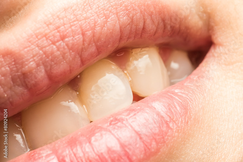 Woman Natural Lips And Teeth Macro
