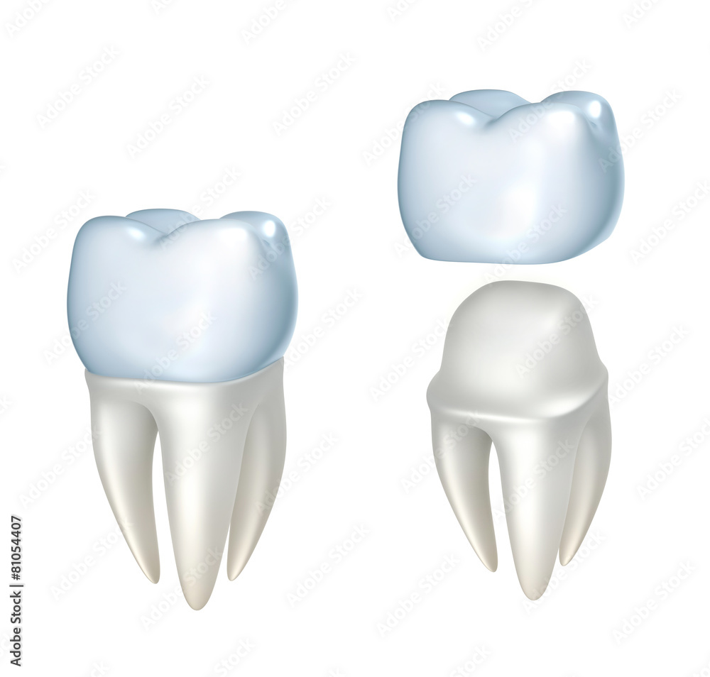 Dental crowns and tooth, isolated on white Dental crowns and tooth, isolated on white