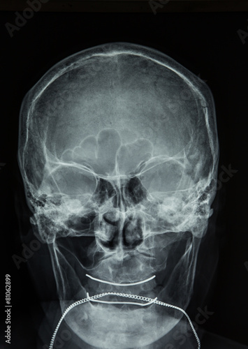 X-ray of head / Many others X-ray images in my portfolio